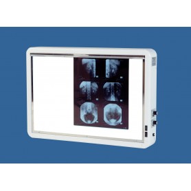 NEGATOSCOPE LUXE 2 plages