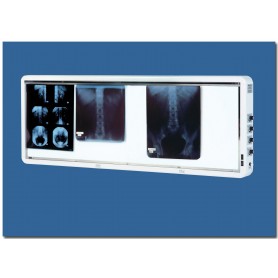 NEGATOSCOPE LUXE 4 plages