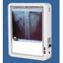 NEGATOSCOPE LUXE 1 plage