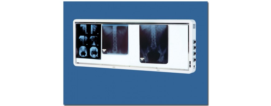  Diagnostic- Négatoscopes